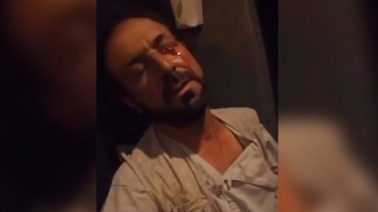 Fuentes: Un combatiente talibán cegó el ojo de un conductor en la ruta Kabul-Norte